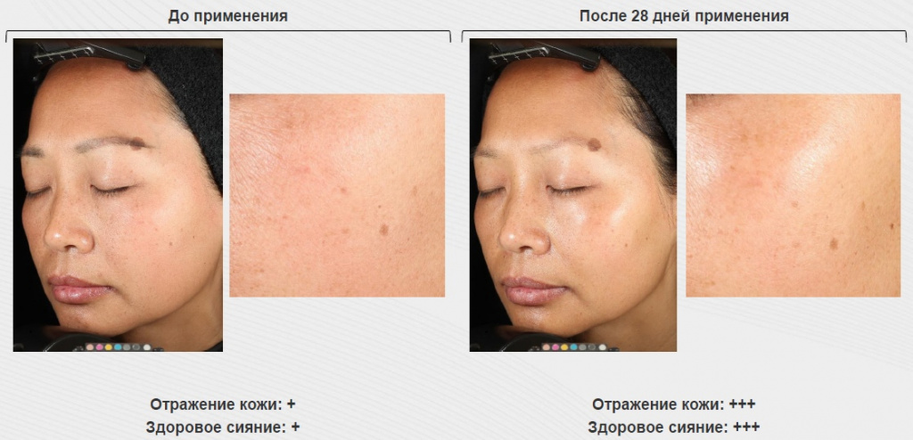 kak-rabotaet-syvorotka-microbiome-smorodina_04.jpg kak-rabotaet-syvorotka-microbiome-smorodina_04.jpg