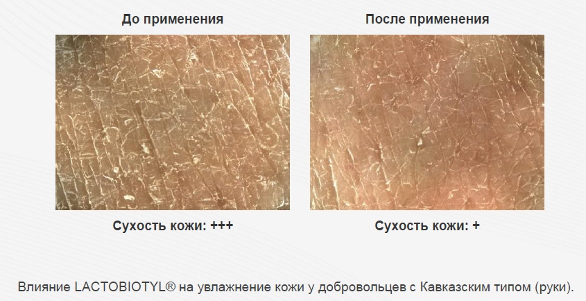 kak-rabotaet-syvorotka-microbiome-smorodina_03.jpg kak-rabotaet-syvorotka-microbiome-smorodina_03.jpg